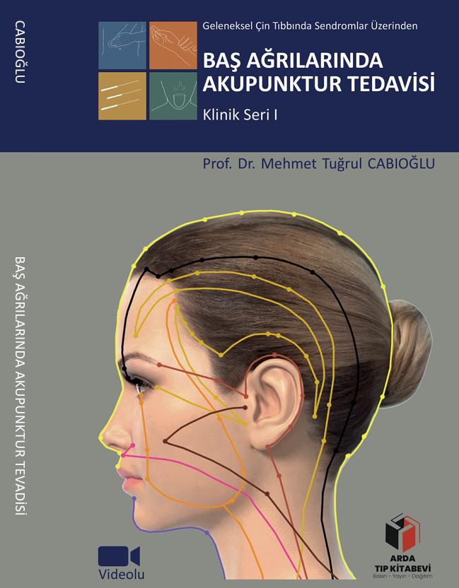 Baş Ağrılarında Akupunktur Tedavisi